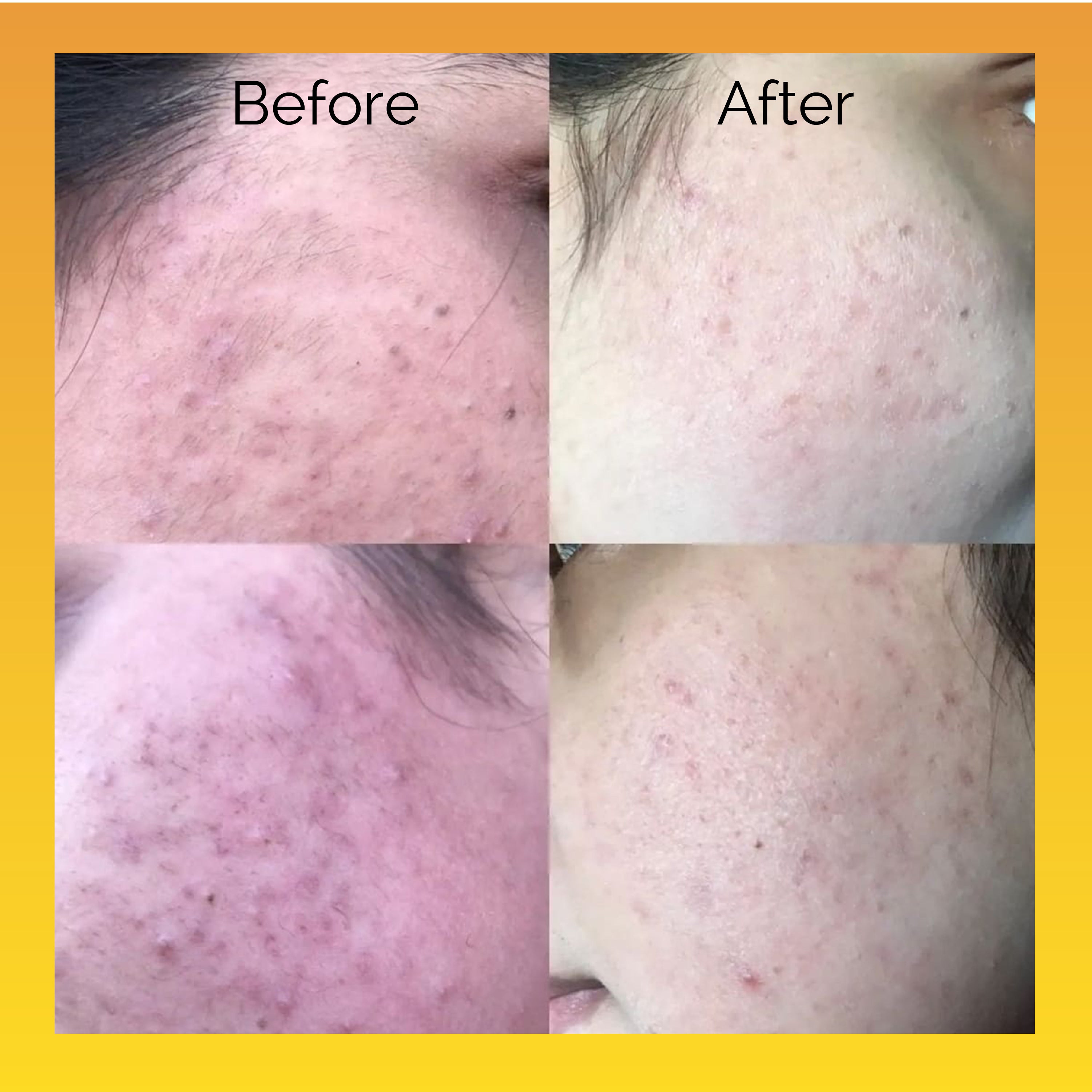 Hello Glow! Vitamin C Serum