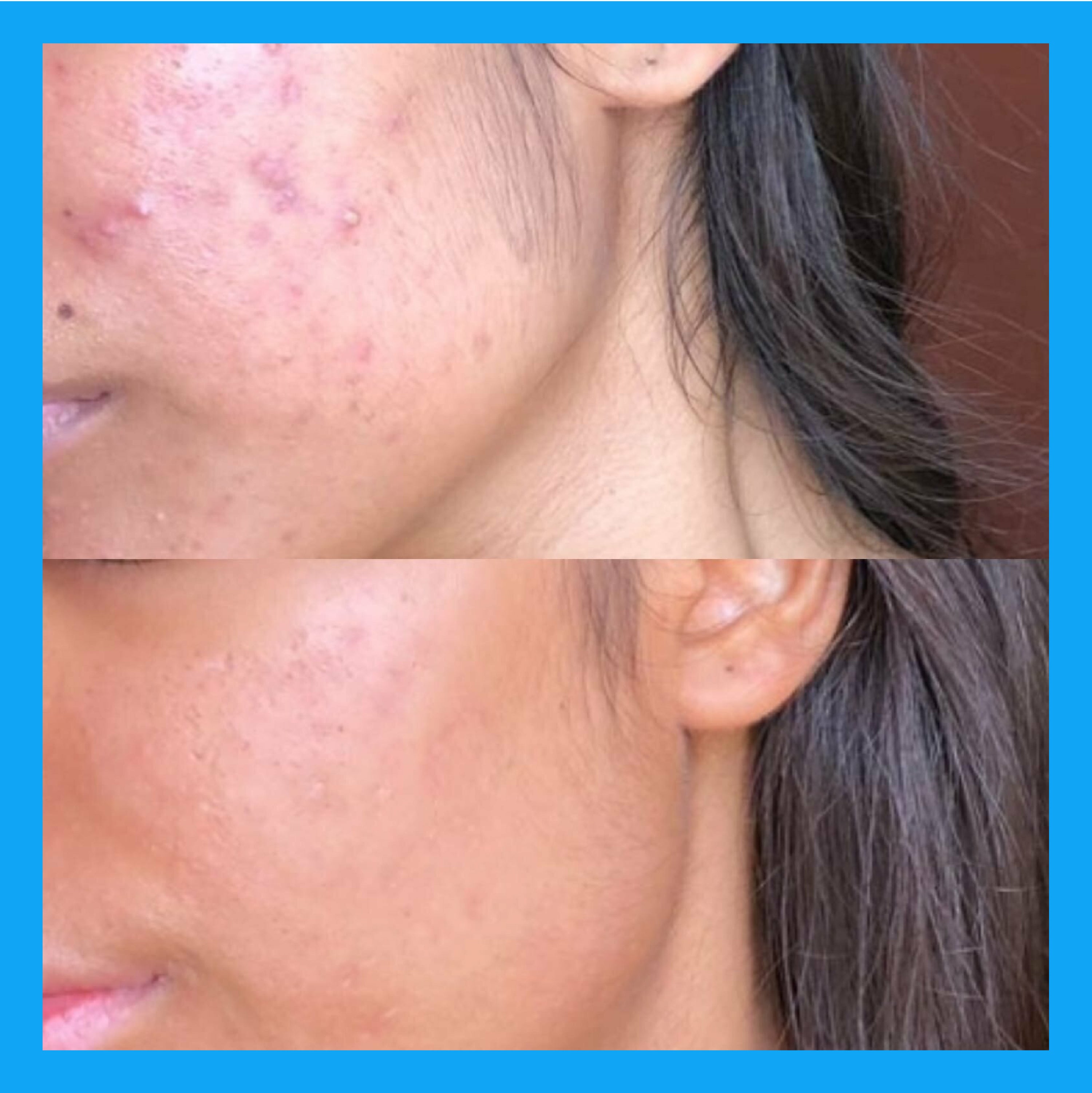 Porefect Niacinamide Toner