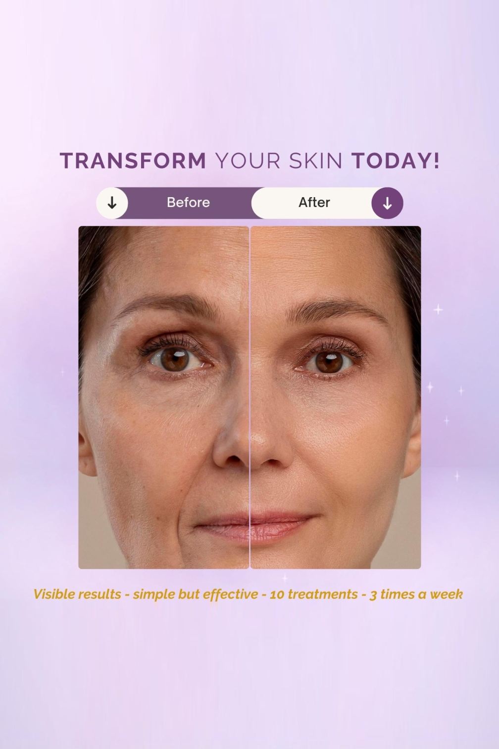 LED Face Therapy Mask