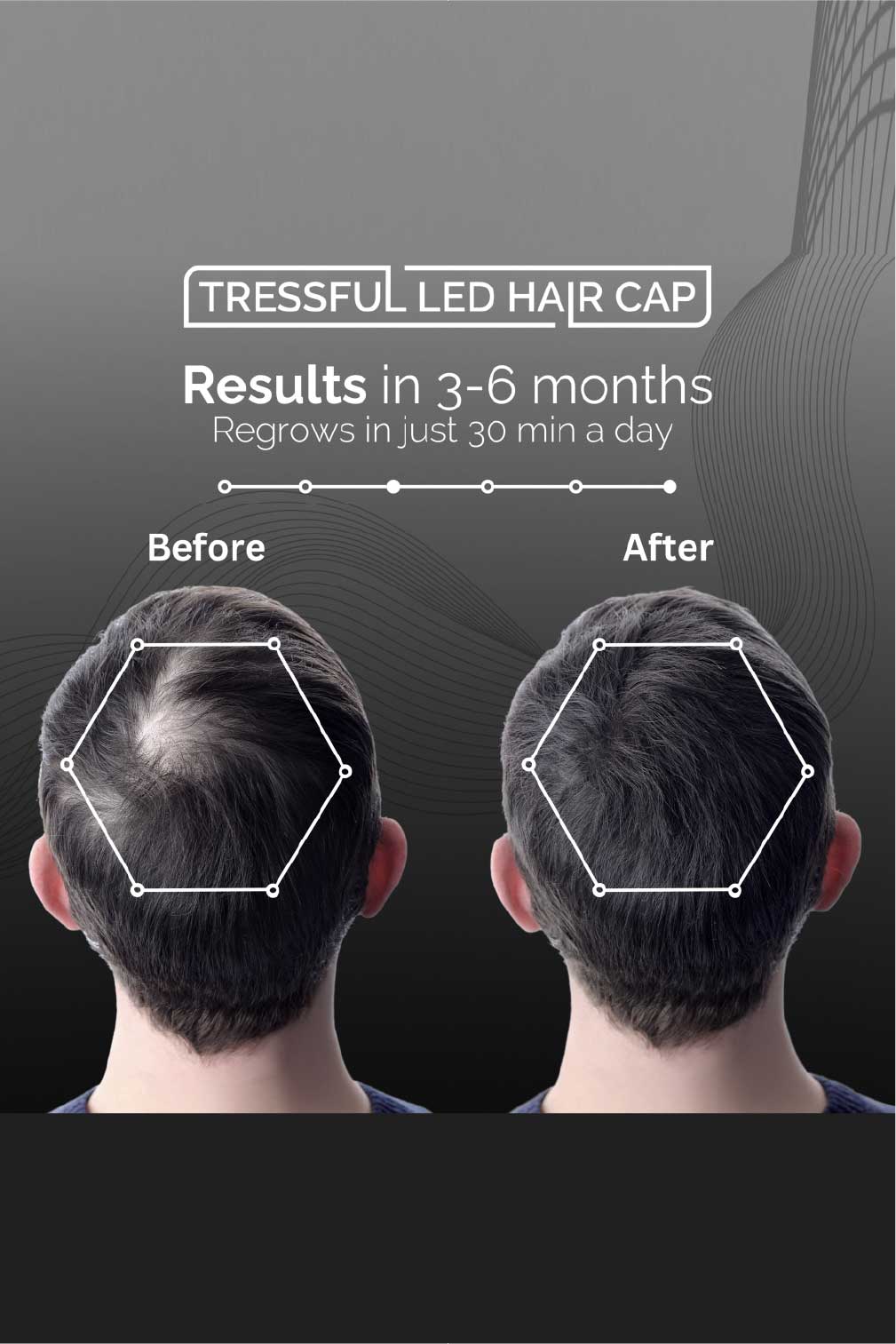 Led Hair Caps