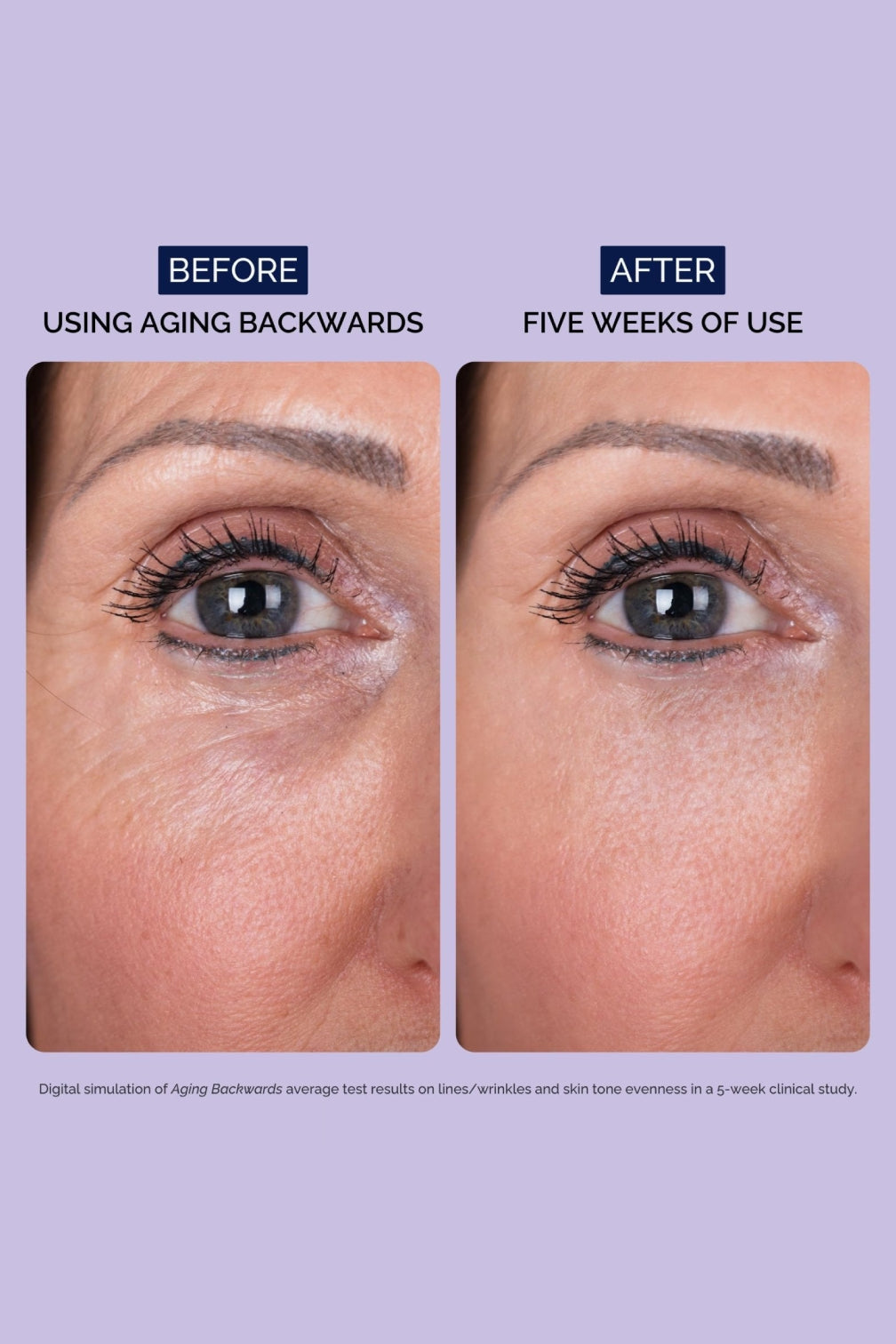 Aging Backwards Retinol Cream
